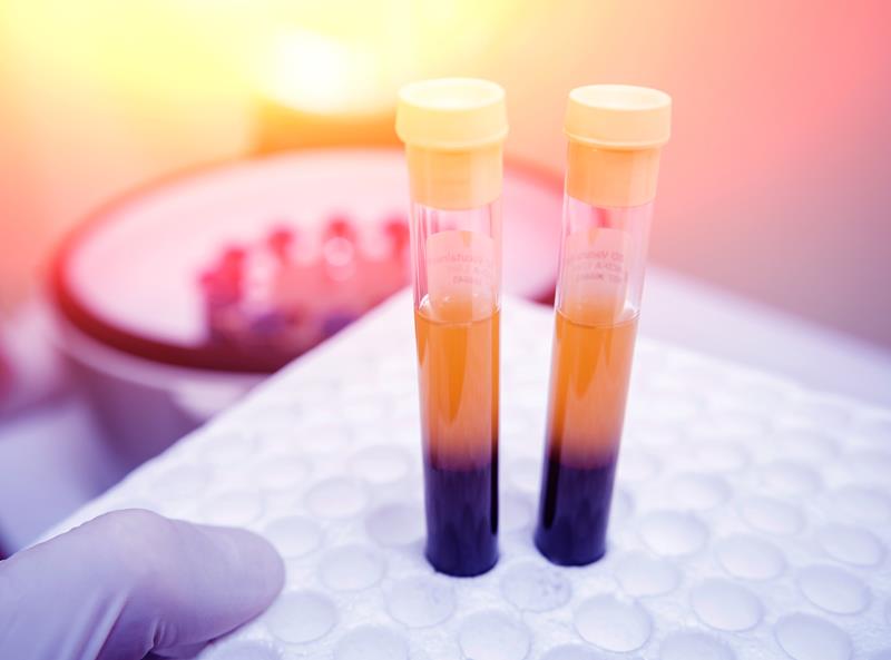 Regenerative Medicine: Bone Marrow Cells and PRP Therapy